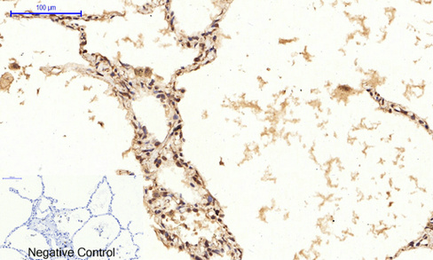 14 - JNK1/2/3 (phospho Thr183/Y185) Polyclonal Antibody AP67089