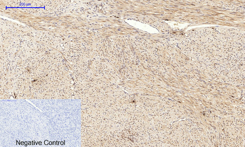 14 - JNK1/2/3 (phospho Thr183/Y185) Polyclonal Antibody AP67089