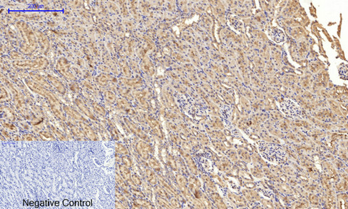 14 - JNK1/2/3 (phospho Thr183/Y185) Polyclonal Antibody AP67089