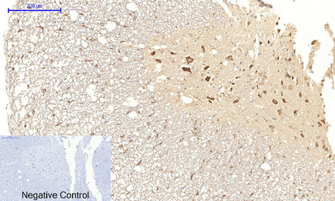 14 - JNK1/2/3 (phospho Thr183/Y185) Polyclonal Antibody AP67089