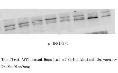 1 - JNK1/2/3 (phospho Thr183/Y185) Polyclonal Antibody AP67089