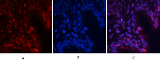 3 - NFκB-p65 (phospho Ser529) Polyclonal Antibody AP67121
