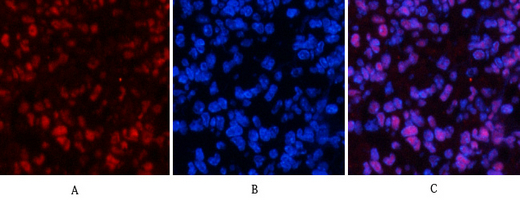 14 - NFκB-p65 (phospho Ser529) Polyclonal Antibody AP67121