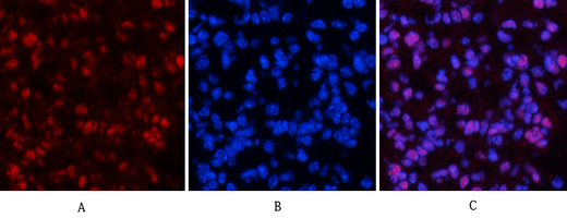 14 - NFκB-p65 (phospho Ser529) Polyclonal Antibody AP67121