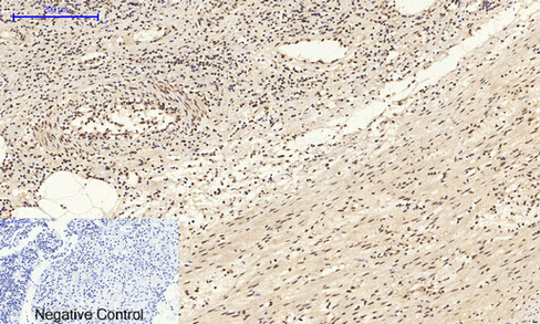 14 - NFκB-p65 (phospho Ser529) Polyclonal Antibody AP67121