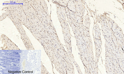 14 - NFκB-p65 (phospho Ser529) Polyclonal Antibody AP67121