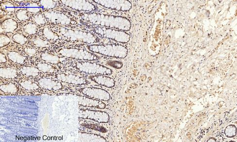 14 - NFκB-p65 (phospho Ser529) Polyclonal Antibody AP67121