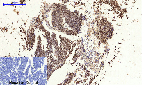 14 - NFκB-p65 (phospho Ser529) Polyclonal Antibody AP67121