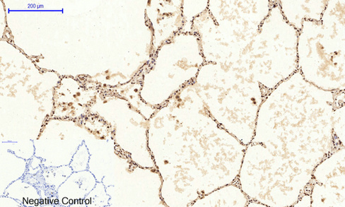 14 - NFκB-p65 (phospho Ser529) Polyclonal Antibody AP67121