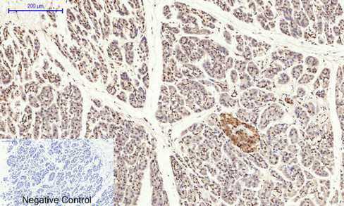 14 - NFκB-p65 (phospho Ser529) Polyclonal Antibody AP67121