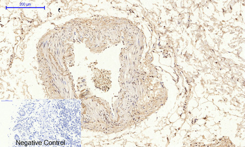 14 - NFκB-p65 (phospho Ser529) Polyclonal Antibody AP67121