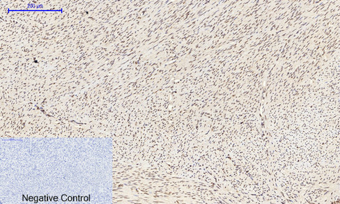 14 - NFκB-p65 (phospho Ser529) Polyclonal Antibody AP67121