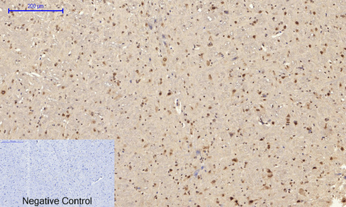 14 - NFκB-p65 (phospho Ser529) Polyclonal Antibody AP67121