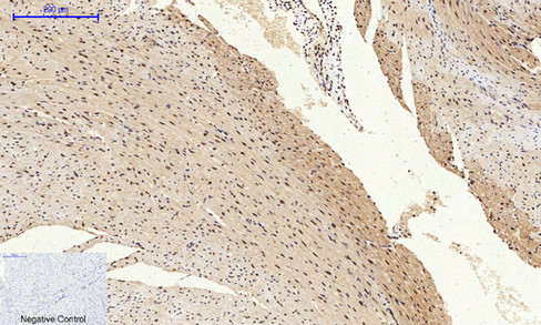 14 - NFκB-p65 (phospho Ser529) Polyclonal Antibody AP67121