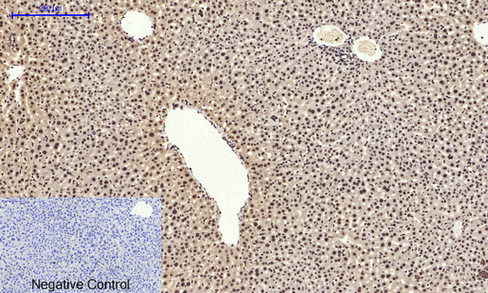 14 - NFκB-p65 (phospho Ser529) Polyclonal Antibody AP67121