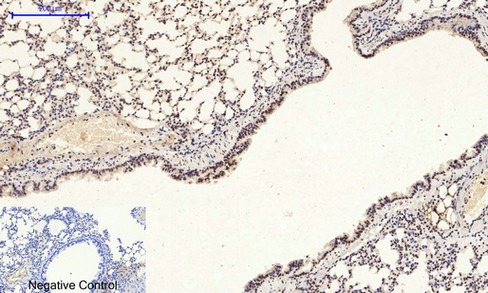 14 - NFκB-p65 (phospho Ser529) Polyclonal Antibody AP67121