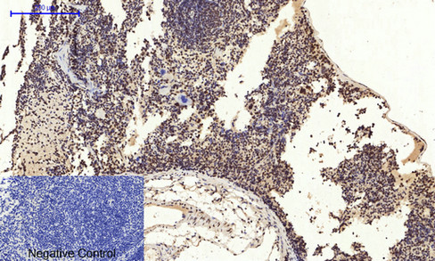 14 - NFκB-p65 (phospho Ser529) Polyclonal Antibody AP67121