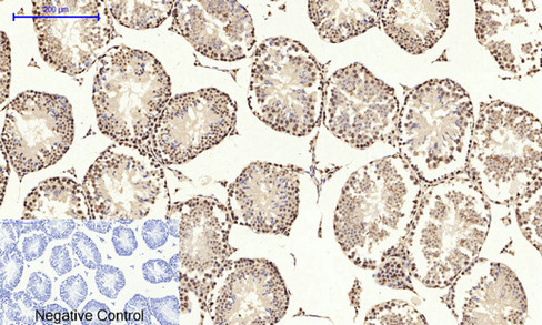 14 - NFκB-p65 (phospho Ser529) Polyclonal Antibody AP67121