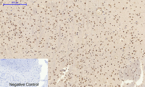 14 - NFκB-p65 (phospho Ser529) Polyclonal Antibody AP67121