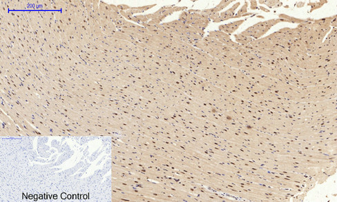 14 - NFκB-p65 (phospho Ser529) Polyclonal Antibody AP67121