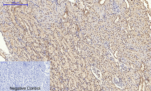 14 - NFκB-p65 (phospho Ser529) Polyclonal Antibody AP67121