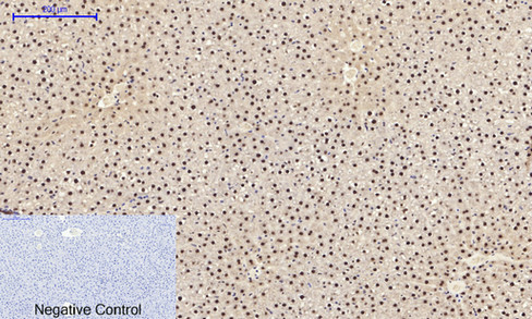 14 - NFκB-p65 (phospho Ser529) Polyclonal Antibody AP67121