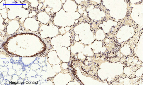 14 - NFκB-p65 (phospho Ser529) Polyclonal Antibody AP67121