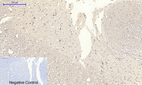 14 - NFκB-p65 (phospho Ser529) Polyclonal Antibody AP67121