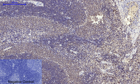 14 - NFκB-p65 (phospho Ser529) Polyclonal Antibody AP67121