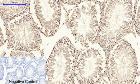 14 - NFκB-p65 (phospho Ser529) Polyclonal Antibody AP67121