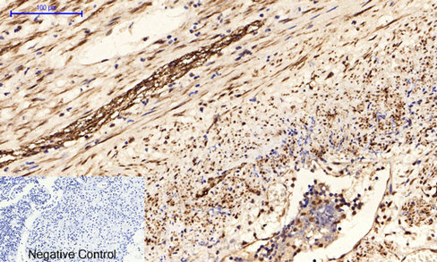 14 - Tau (phospho Ser396) Polyclonal Antibody AP67195