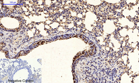 14 - Tau (phospho Ser396) Polyclonal Antibody AP67195