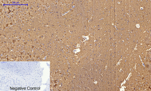 14 - Tau (phospho Ser396) Polyclonal Antibody AP67195