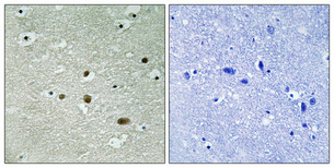 1 - B23 (phospho Thr234) Polyclonal Antibody AP67318