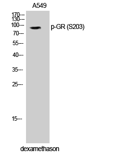 1 - GR (phospho Ser203) Polyclonal Antibody AP67344