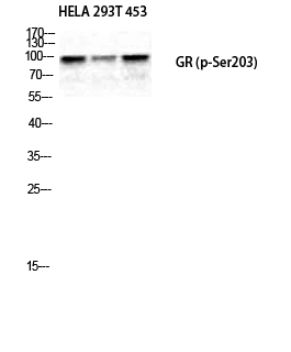 1 - GR (phospho Ser203) Polyclonal Antibody AP67344