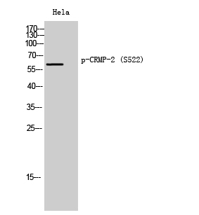 1 - CRMP-2 (phospho Ser522) Polyclonal Antibody AP67445