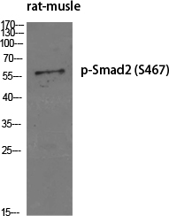 1 - Smad2 (phospho Ser467) Polyclonal Antibody AP67516