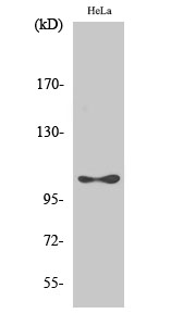 1 - eEF2K (phospho Ser366) Polyclonal Antibody AP67531