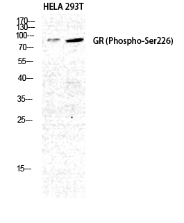 1 - GR (phospho Ser226) Polyclonal Antibody AP67566