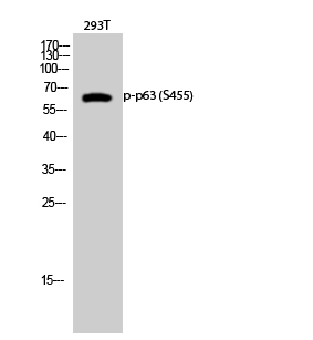 1 - p63 (phospho Ser455) Polyclonal Antibody AP67631