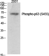 1 - p63 (phospho Ser455) Polyclonal Antibody AP67631