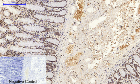 14 - JNK1/2/3 (phospho Tyr185) Polyclonal Antibody AP67775