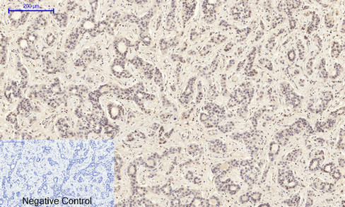 14 - JNK1/2/3 (phospho Tyr185) Polyclonal Antibody AP67775