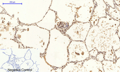 14 - JNK1/2/3 (phospho Tyr185) Polyclonal Antibody AP67775