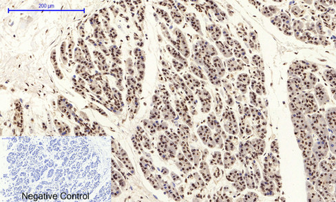 14 - JNK1/2/3 (phospho Tyr185) Polyclonal Antibody AP67775