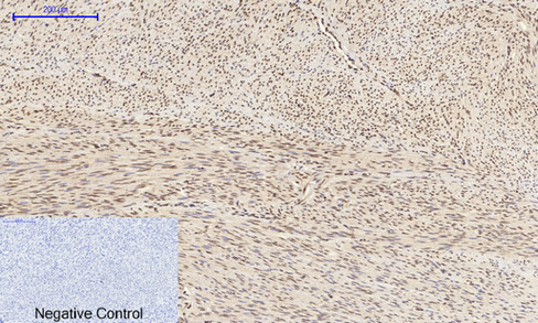 14 - JNK1/2/3 (phospho Tyr185) Polyclonal Antibody AP67775