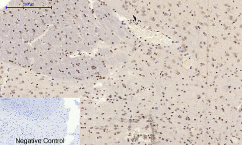 14 - JNK1/2/3 (phospho Tyr185) Polyclonal Antibody AP67775