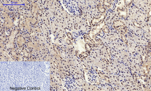 14 - JNK1/2/3 (phospho Tyr185) Polyclonal Antibody AP67775