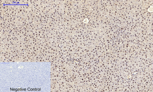 14 - JNK1/2/3 (phospho Tyr185) Polyclonal Antibody AP67775